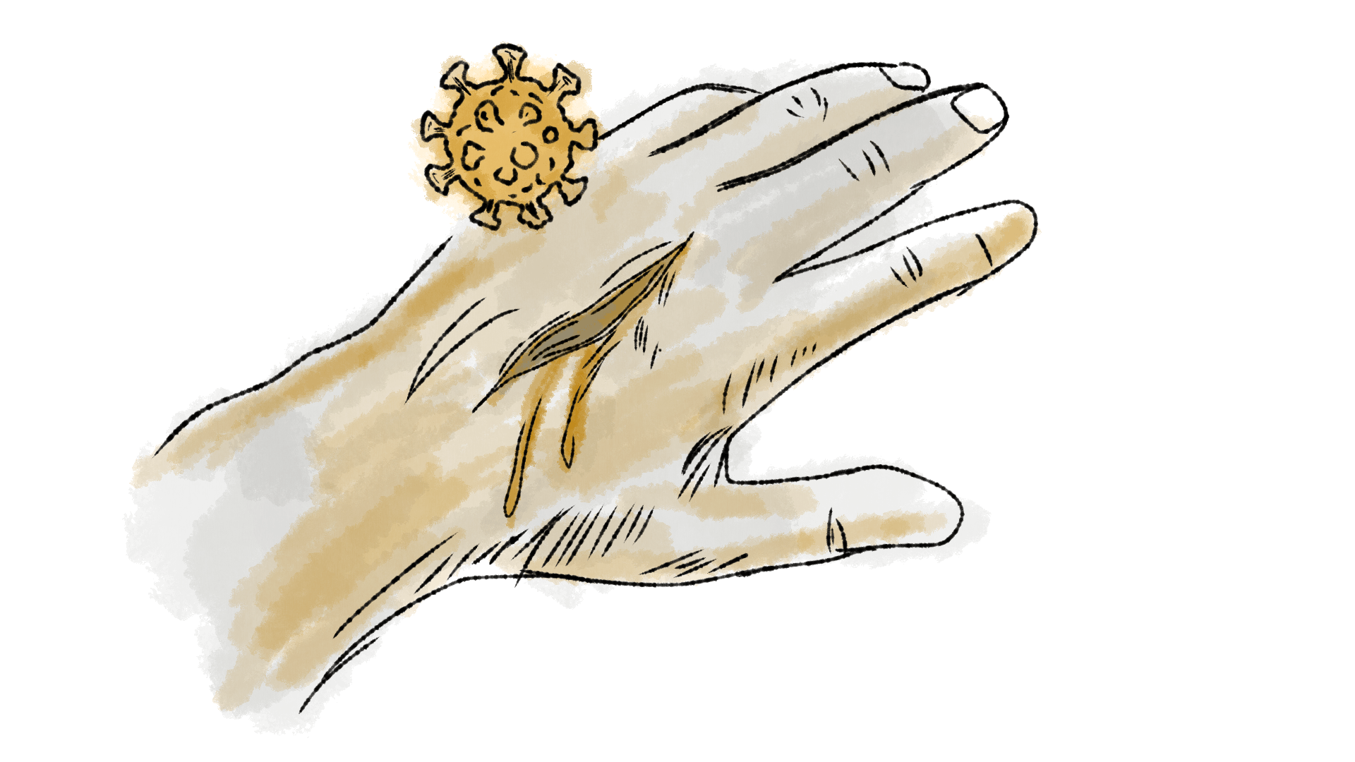 Illustration of an open wound.
